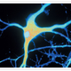 Illustration for article titled New evidence that Alzheimers disease is infectious
